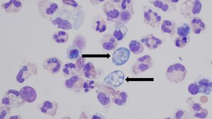 Microscopic image of protozoan parasites