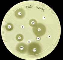 Antibiotic disk diffusion image