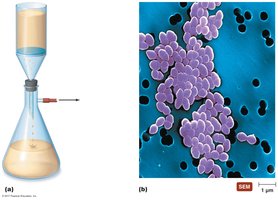 Membrane filtration setup