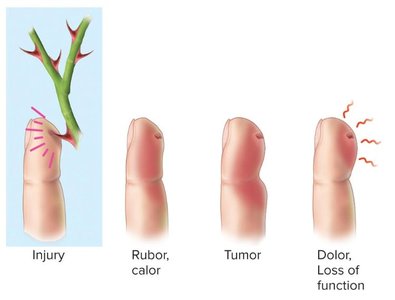 Stages of inflammation
