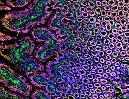 Fluorescence micrograph of tissue with multiple fluorescent labels