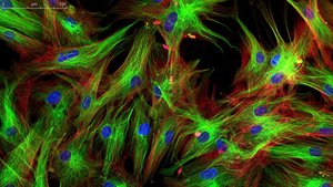 Fluorescence micrograph showing labeled cellular structures