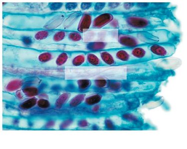 Ascospores in an ascus