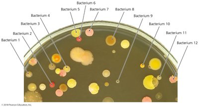 Bacterial colonies on agar plate