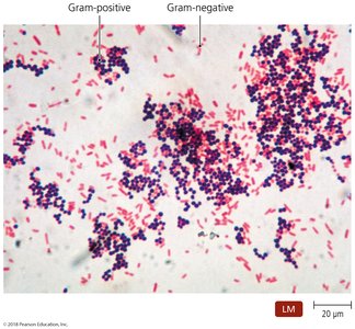 Gram stain results: Gram-positive and Gram-negative bacteria