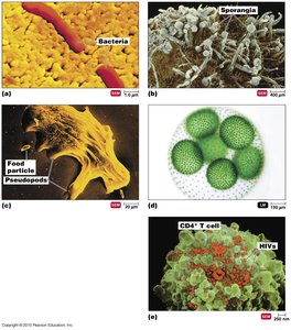 Types of microorganisms: bacteria, fungi, protozoa, algae, viruses