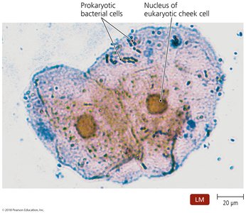 Bacterial cells and human cheek cells under microscope