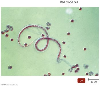 Parasitic worm in blood