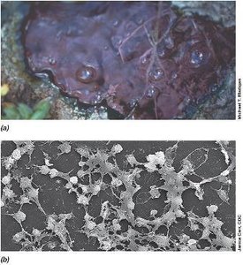 Microbial mat and biofilm on catheter