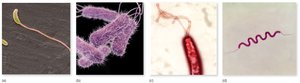 Types of flagellar arrangements