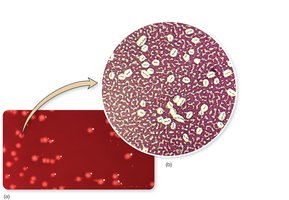 Micrograph of encapsulated bacteria
