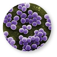 Micrograph of Staphylococcus cocci