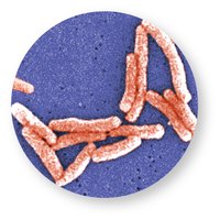 Micrograph of Legionella bacilli