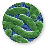 Micrograph of Vibrio vulnificus