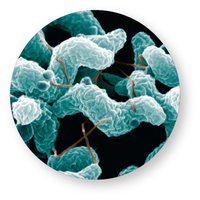 Micrograph of Campylobacter jejuni (spirillum)
