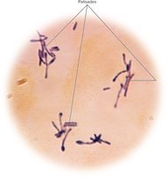 Micrograph of bacilli in palisades arrangement