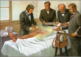 Joseph Lister performing surgery