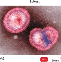 Morphology of enveloped helical virus