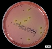 Selective media plate with bacterial colonies