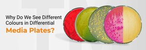 Differential media plates showing different colors