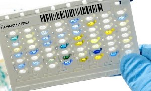 Automated bacterial identification system