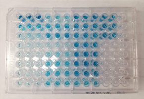 ELISA principle diagram