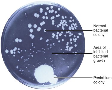 Discovery of penicillin: Petri dish with Penicillium and inhibited bacterial growth