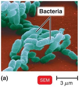 SEM of bacteria