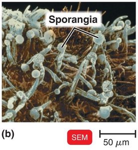 SEM of fungal sporangia