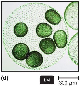 LM of green algae Volvox
