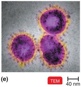 TEM of enveloped coronavirus