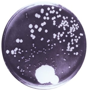 Petri dish showing penicillin inhibition of bacteria