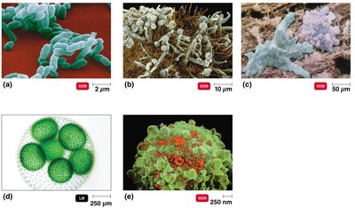 Types of microorganisms: bacteria, fungi, protozoa, algae, viruses