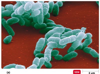 Haemophilus influenzae, a rod-shaped bacterium