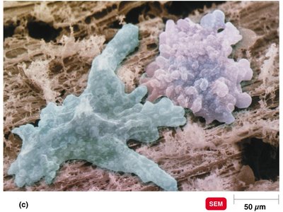 Amoeba, a protozoan, approaching a food particle