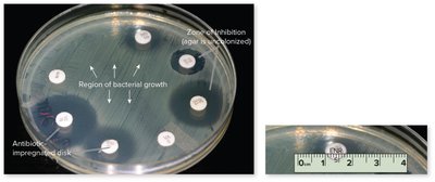 Kirby–Bauer disc diffusion test