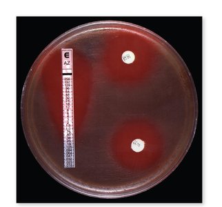 Etest for antimicrobial susceptibility