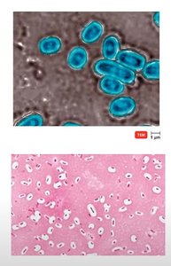Biofilm formation steps