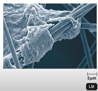 Biofilm on catheter surface