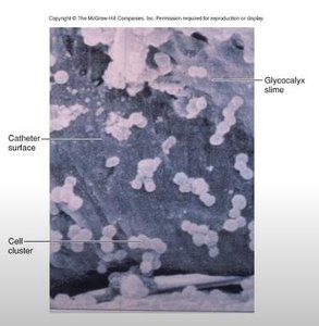 Biofilm on medical device (close-up)