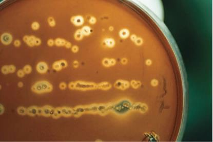 Colony with zone of beta hemolysis on enriched media