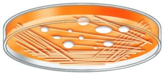 MacConkey agar showing lactose fermenters and non-fermenters