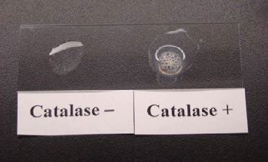 Test tubes showing growth patterns of bacteria with different oxygen requirements