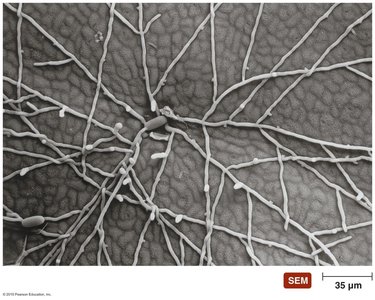 SEM of fungal hyphae and spores