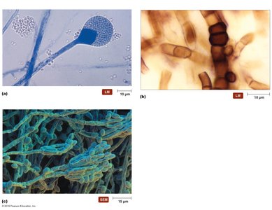 Light and electron micrographs of fungal spores and reproductive structures