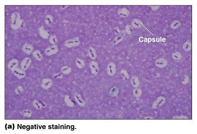 Acid-fast staining of Mycobacterium leprae