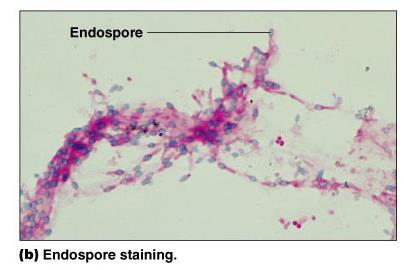 Negative staining for capsules