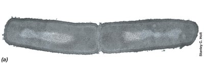 TEM image of bacterial cell structure