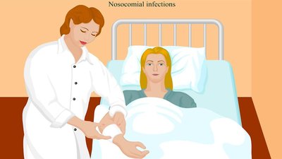 Nosocomial infections in a hospital setting