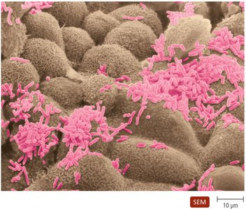 Scanning electron micrograph of normal microbiota on intestinal surface
